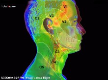 thermal imaging head